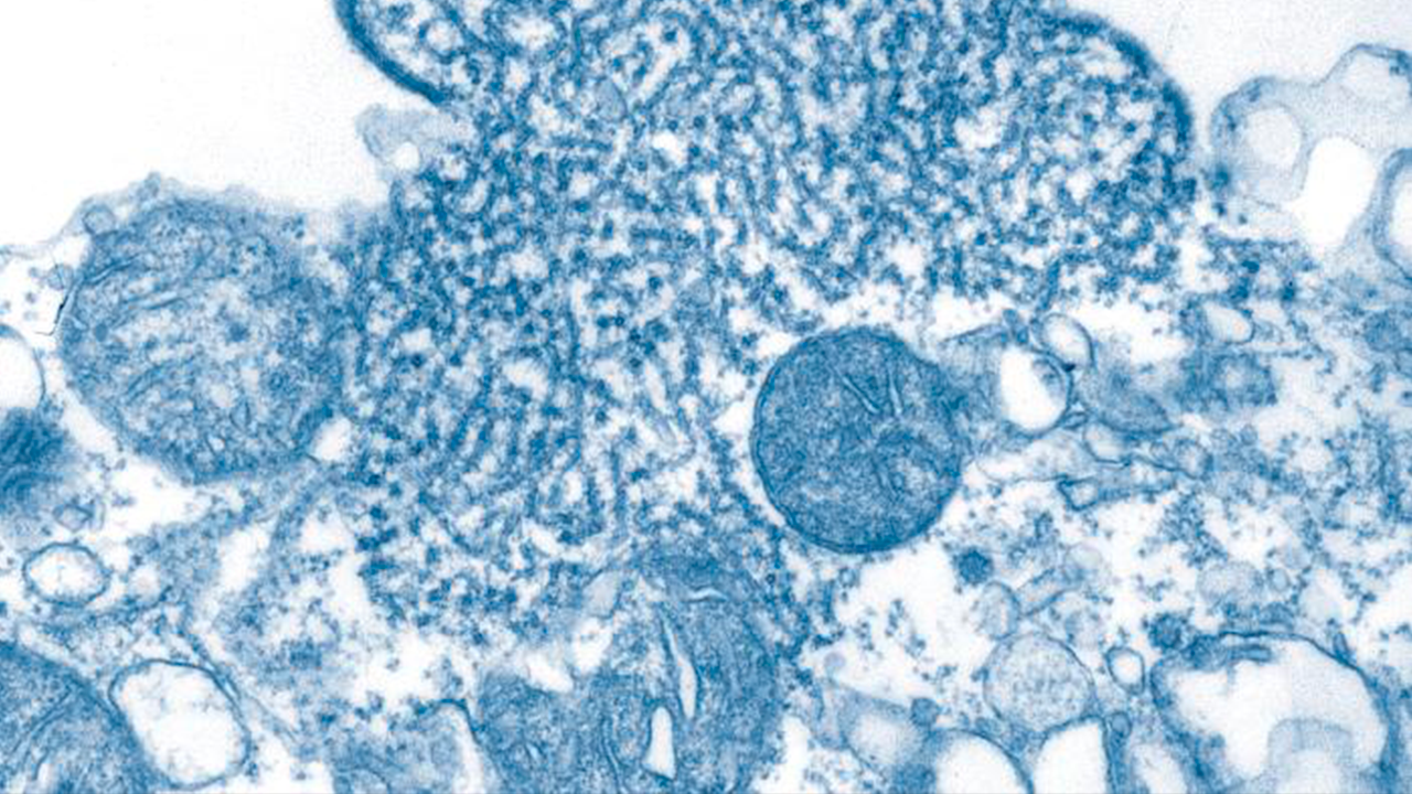 Virus Nipah bajo un microscopio electrónico de transmisión · Foto: Crédito: CDC / WikiCommons