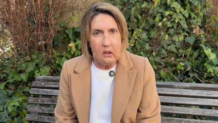 Mujer que recibió la donación de rostro. Crédito: Vall d’Hebron